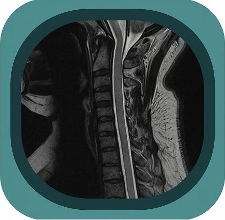 mri C spine  anatomy icon